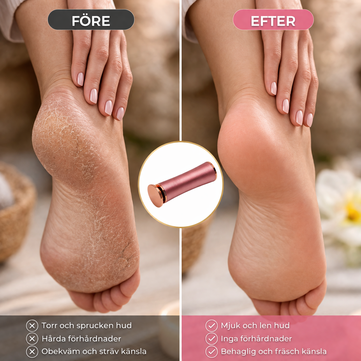 Velia® Fotslip - Känn dig bekväm i sommar