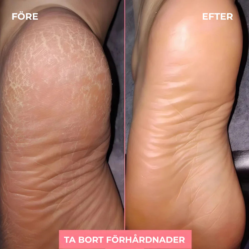 Velia® Fotslip - Känn dig bekväm i sommar